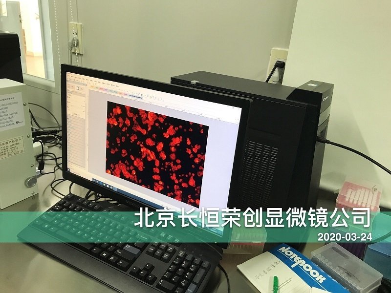 熒光顯微鏡拍照CCD安裝于河南大學