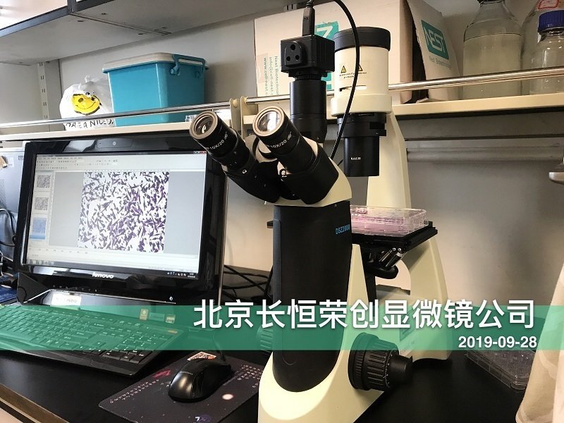 倒置數碼顯微鏡安裝于腫瘤醫院1