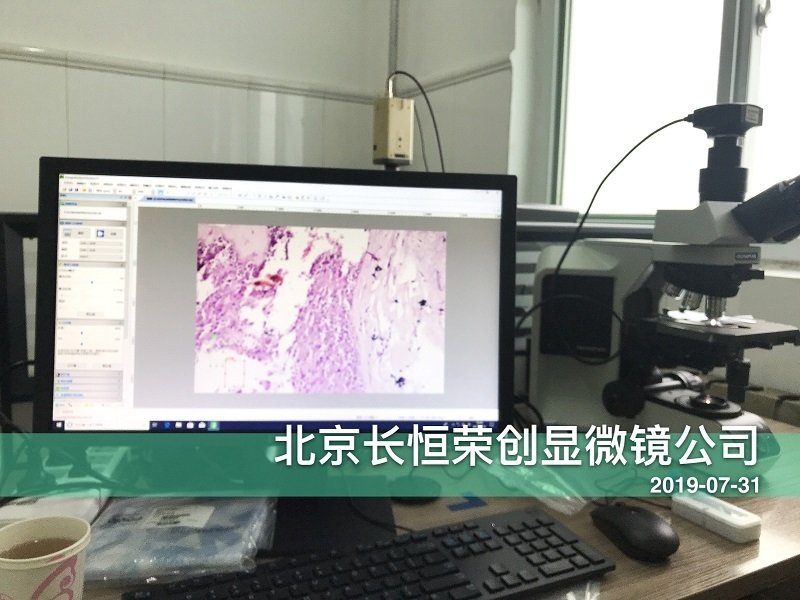 奧林巴斯BX53顯微鏡安裝于北京市婦幼保健醫院