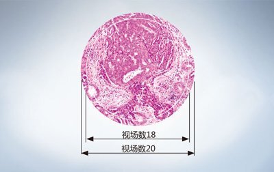 奧林巴斯顯微鏡CX23功能詳解 奧林巴斯顯微鏡CX23功能詳解
