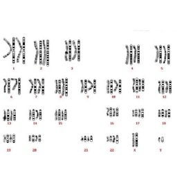 染色體核型配對分析